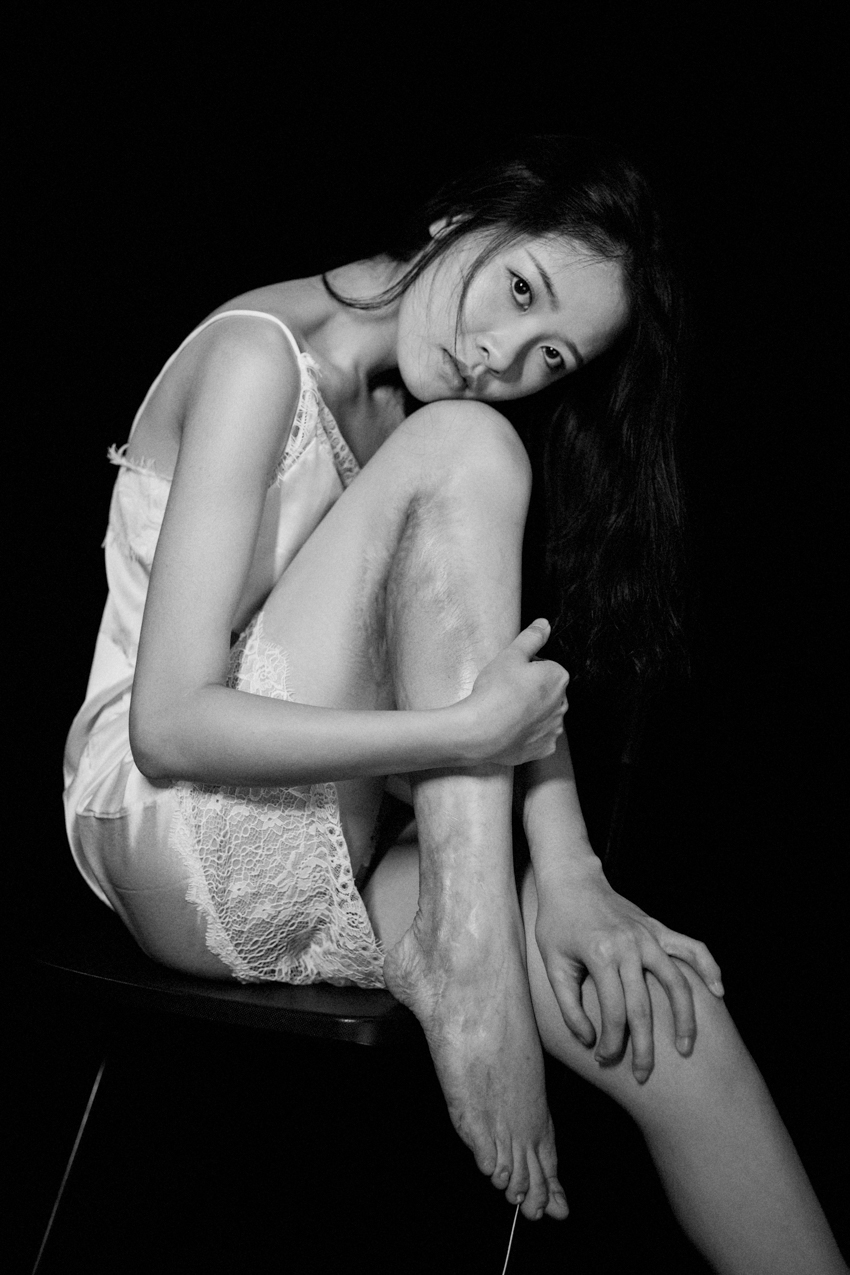 我是来拍疤的 我是来拍疤的