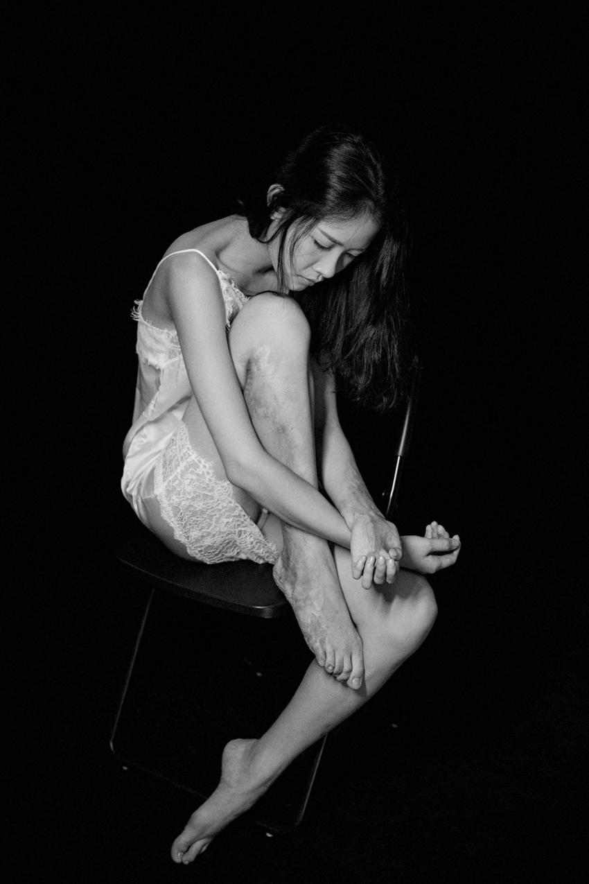 我是来拍疤的 我是来拍疤的